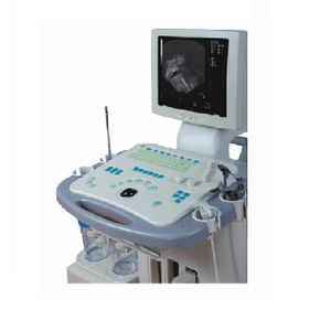 Máquina de sistema de diagnóstico ultrassônico visível aprovado pela CE/ISO (MT01006081)