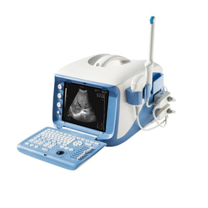 Máquina portátil de sistema de diagnóstico ultrassônico 4D hospitalar (MT01006101)
